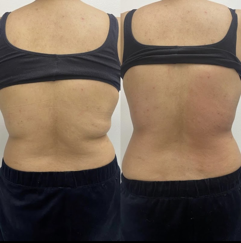 Oasis Body Sculpting, spa in Yucaipa, CA, photo 2 of 9